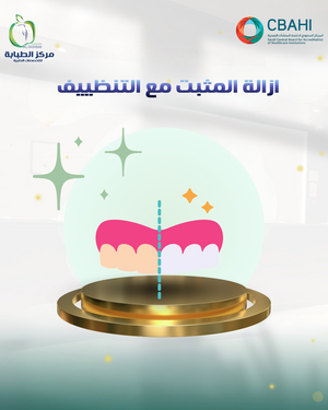 Retainer Removal with Cleaning