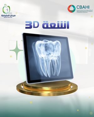 اشعة 3D