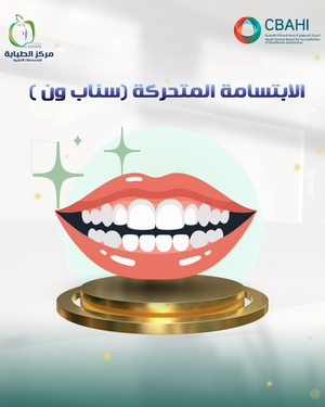 الابتسامة المتحركة ( سناب ون)