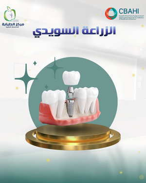 الزراعة السويدي