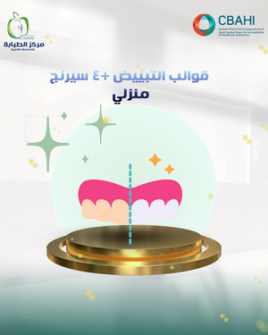 قوالب التبييض +4 سرنج منزلي