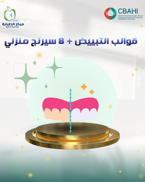 قوالب التبييض +8 سرنج منزلي