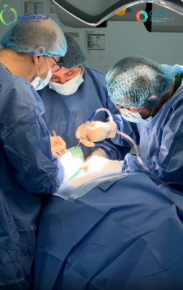 زراعة الاسنان