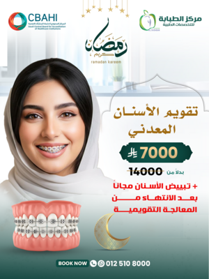 تقويم الاسنان المعدني