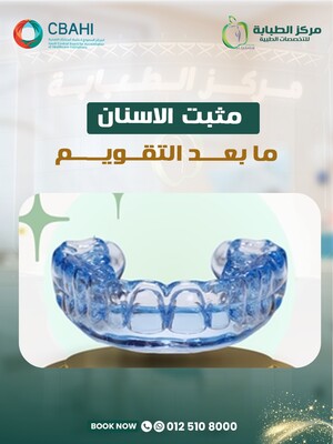 Retainer for One Arch