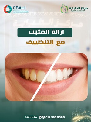 Retainer Removal with Cleaning