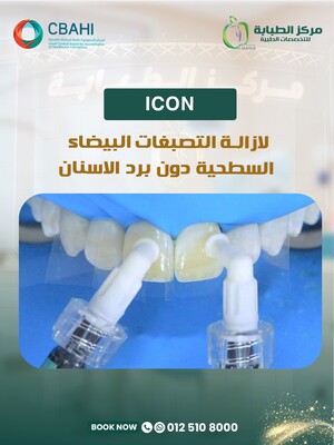 Icon for White Spots