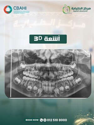 3D X-ray