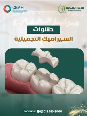 Ceramic Fillings