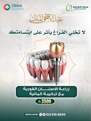 زراعة الأسنان الفورية مع التركيبة الألمانية