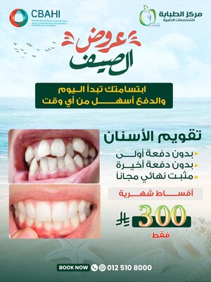 تقويم الأسنان بدون دفعة أولى بدون دفعة أخيرة مثبت نهائي مجاناً بقسط شهري يبدأ من 300 ريال