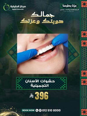 حشوات الأسنان التجميلية