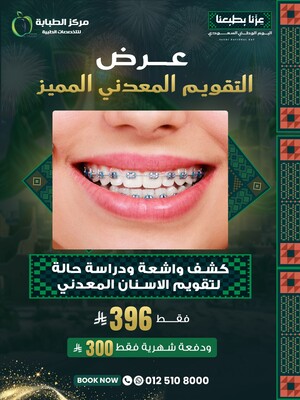 كشف وأشعة ودراسة حالة للتقويم المعدني (دفعة شهرية 300 ريال)