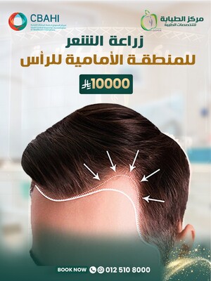 زراعة الشعر للمنطقة الأمامية للرأس