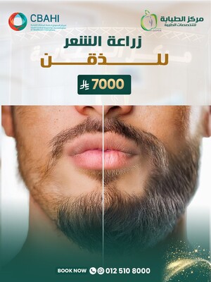 زراعة الشعر للذقن