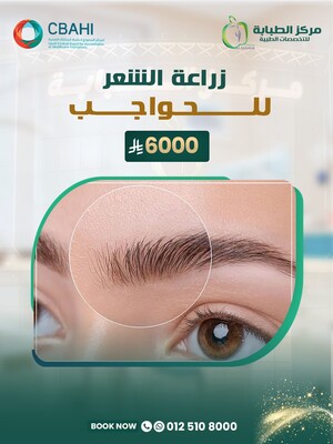 زراعة الشعر للحواجب